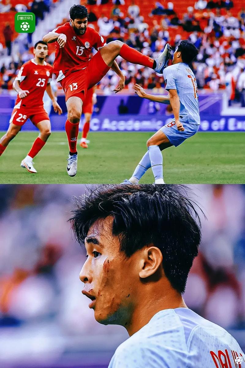 Hiện Tượng Siêu Dẫn